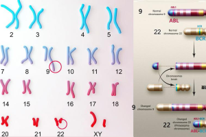 青春痘新方向针对基因、microbiome和环境因子的治疗